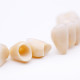 coroane-dentare-integral-ceramice-(2)